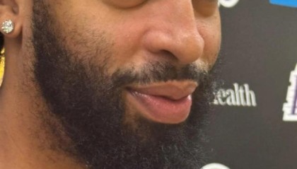 星空体育app下载-湖人内线一喜一忧——戴维斯眼部无恙，伍德伤情反复